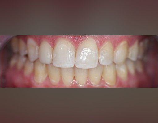 attractive smile
