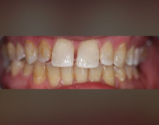 unsightly smile